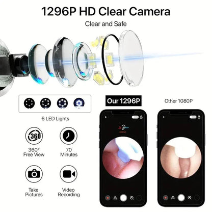 Visual Ear Cleaning Tool with HD Camera